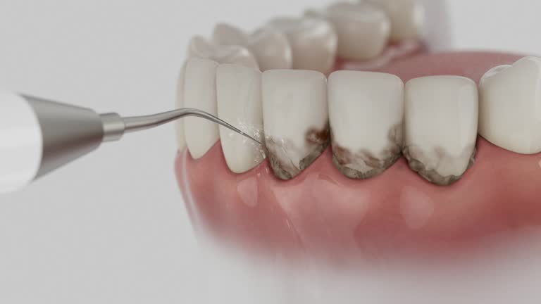 Reliable Teeth Cleaning And Checkup contractor in Union County County, GA by Dentist Open Now